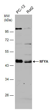 Various whole cell extracts (30 μg) were separated by 10% SDS-PAGE, and the membrane was blotted with NFYA antibody (GTX109511) diluted at 1:3000. The HRP-conjugated anti-rabbit IgG antibody (GTX213110-01) was used to detect the primary antibody.