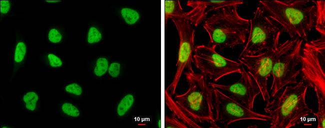 NFYA antibody detects NFYA protein at nucleus by immunofluorescent analysis. Sample: HeLa cells were fixed in 4% paraformaldehyde at RT for 15 min. Green: NFYA stained by NFYA antibody (GTX109511) diluted at 1:500. Red: phalloidin, a cytoskeleton marker, diluted at 1:100. Scale bar= 10 μm.