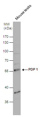 PDP 1 antibody detects PDP 1 protein by western blot analysis. Mouse tissue extracts (50 μg) was separated by 10% SDS-PAGE, and the membrane was blotted with PDP 1 antibody (GTX109533) diluted at 1:1000.