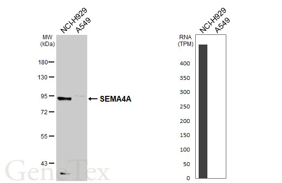 Various whole cell extracts (30 μg) were separated by 7.5% SDS-PAGE, and the membrane was blotted with SEMA4A antibody [C1C3] (GTX109538) diluted at 1:500. The HRP-conjugated anti-rabbit IgG antibody (GTX213110-01) was used to detect the primary antibody. Corresponding RNA expression data are based on Human Protein Atlas program.