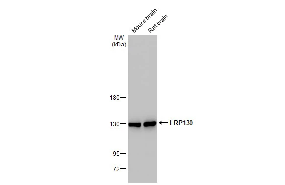 Various tissue extracts (50 μg) were separated by 5% SDS-PAGE, and the membrane was blotted with LRP130 antibody [N3C2], Internal (GTX109558) diluted at 1:1000. The HRP-conjugated anti-rabbit IgG antibody (GTX213110-01) was used to detect the primary antibody.