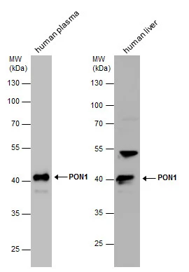 PON1 antibody detects PON1 protein by western blot analysis. Human tissue extracts (30 μg) was separated by 10% SDS-PAGE, and the membrane was blotted with PON1 antibody (GTX109561) diluted at 1:1000.