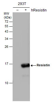 Non-transfected (–) and transfected (+) 293T whole cell extracts (30 μg) were separated by 15% SDS-PAGE, and the membrane was blotted with Resistin antibody [N1C3] (GTX109562) diluted at 1:5000.
