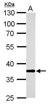 AKR1B10 antibody detects AKR1B10 protein by western blot analysis. A. 50 μg mouse colon lysate/extract 10% SDS-PAGE AKR1B10 antibody (GTX109571) dilution: 1:5000 The HRP-conjugated anti-rabbit IgG antibody (GTX213110-01) was used to detect the primary antibody. AKR1B10 antibody detects AKR1B10 protein by western blot analysis. A. 50 μg mouse colon lysate/extract 10% SDS-PAGE AKR1B10 antibody (GTX109571) dilution: 1:5000 The HRP-conjugated anti-rabbit IgG antibody (GTX213110-01) was used to detect the primary antibody.