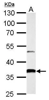 AKR1B10 antibody detects AKR1B10 protein by western blot analysis. A. 50 μg rat colon lysate/extract 10% SDS-PAGE AKR1B10 antibody (GTX109571) dilution: 1:5000 The HRP-conjugated anti-rabbit IgG antibody (GTX213110-01) was used to detect the primary antibody.