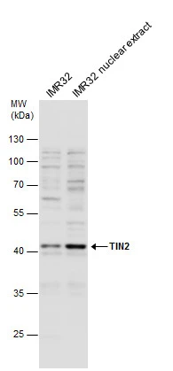 TIN2 antibody detects TINF2 protein by western blot analysis. IMR32 whole cell extracts and nuclear extracts (30 μg) were separated by 10% SDS-PAGE, and the membrane was blotted with TIN2 antibody (GTX109576) diluted at 1:1000.