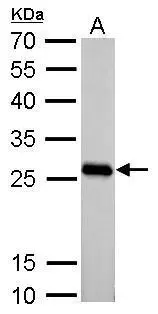 PGAM2 antibody detects PGAM2 protein by Western blot analysis. A. 50 μg rat muscle lysate/extract 12 % SDS-PAGE PGAM2 antibody (GTX109582) dilution: 1:10000 PGAM2 antibody detects PGAM2 protein by Western blot analysis. A. 50 μg rat muscle lysate/extract 12 % SDS-PAGE PGAM2 antibody (GTX109582) dilution: 1:10000