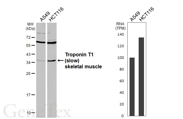 Various whole cell extracts (30 μg) were separated by 12% SDS-PAGE, and the membrane was blotted with Troponin T1 (slow) skeletal muscle antibody (GTX109585) diluted at 1:1000. The HRP-conjugated anti-rabbit IgG antibody (GTX213110-01) was used to detect the primary antibod, and the signal was developed with Trident femto Western HRP Substrate. Corresponding RNA expression data are based on Human Protein Atlas program. Various whole cell extracts (30 μg) were separated by 12% SDS-PAGE, and the membrane was blotted with Troponin T1 (slow) skeletal muscle antibody (GTX109585) diluted at 1:1000. The HRP-conjugated anti-rabbit IgG antibody (GTX213110-01) was used to detect the primary antibod, and the signal was developed with Trident femto Western HRP Substrate. Corresponding RNA expression data are based on Human Protein Atlas program.