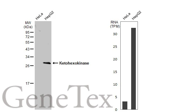 Various whole cell extracts (30 μg) were separated by 12% SDS-PAGE, and the membrane was blotted with Ketohexokinase antibody [N1C3] (GTX109591) diluted at 1:1000. The HRP-conjugated anti-rabbit IgG antibody (GTX213110-01) was used to detect the primary antibody, and the signal was developed with Trident ECL plus-Enhanced. Corresponding RNA expression data for the same cell lines are based on Human Protein Atlas program.