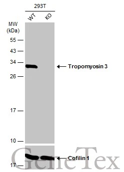 Wild-type (WT) and Tropomyosin 3 knockout (KO) 293T cell extracts (30 μg) were separated by 12% SDS-PAGE, and the membrane was blotted with Tropomyosin 3 antibody (GTX109592) diluted at 1:1000. The HRP-conjugated anti-rabbit IgG antibody (GTX213110-01) was used to detect the primary antibody.