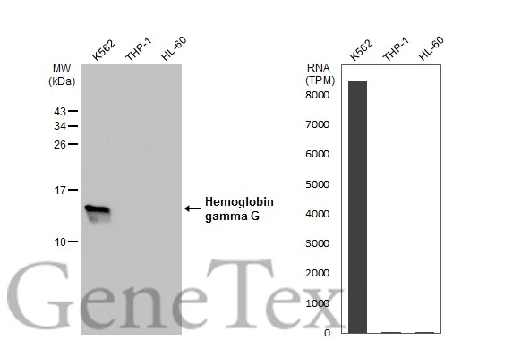 Various whole cell extracts (30 μg) were separated by 15% SDS-PAGE, and the membrane was blotted with Hemoglobin gamma G antibody (GTX109601) diluted at 1:500. The HRP-conjugated anti-rabbit IgG antibody (GTX213110-01) was used to detect the primary antibody. Corresponding RNA expression data for the same cell lines are based on Human Protein Atlas program.