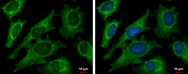 DECR1 antibody [N1C3] detects DECR1 protein at mitochondria by immunofluorescent analysis.Sample:HeLa cells were fixed in ice-cold MeOH for 5 min.Green:DECR1 protein stained by DECR1 antibody [N1C3] (GTX109608)diluted at 1:500.Blue:Hoechst 33342 staining.