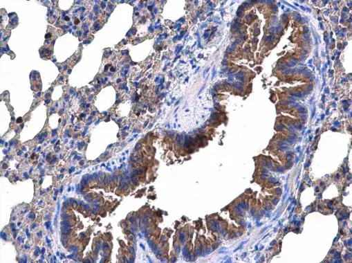 p53R2 antibody [N1C3] detects p53R2 protein at cytoplasm in mouse lung by immunohistochemical analysis. Sample: Paraffin-embedded mouse lung. p53R2 antibody [N1C3] (GTX109620) diluted at 1:500. 
 Antigen Retrieval: Citrate buffer, pH 6.0, 15 min