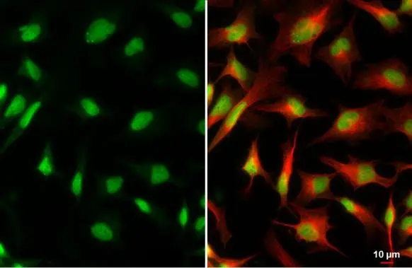 XRCC4 antibody detects XRCC4 protein at nucleus by immunofluorescent analysis. Sample: HeLa cells were fixed in 4% paraformaldehyde at RT for 15 min. Green: XRCC4 stained by XRCC4 antibody (GTX109632) diluted at 1:200. Red: alpha Tubulin, a cytoskeleton marker, stained by alpha Tubulin antibody [GT114] (GTX628802) diluted at 1:1000.