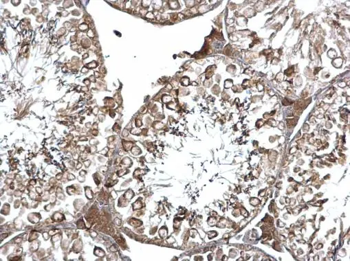 EEA1 antibody [C3], C-term detects EEA1 protein at cytosol on mouse testis by immunohistochemical analysis. Sample: Paraffin-embedded mouse testis. EEA1 antibody [C3], C-term (GTX109638) dilution: 1:500. 
 Antigen Retrieval: Trilogy? (EDTA based, pH 8.0) buffer, 15min