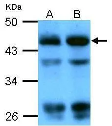 Sample (whole cell lysate) A: Candida albicans (sc5314) 20ug B: Candida albicans (sc5314) 40ug 10% SDS PAGE GTX109639 diluted at 1:4000 The HRP-conjugated anti-rabbit IgG antibody (GTX213110-01) was used to detect the primary antibody.