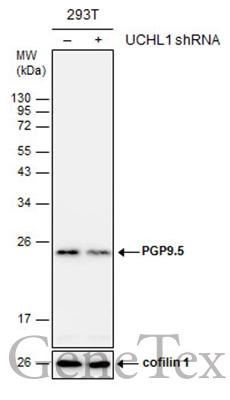 Non-transfected (–) and transfected (+) 293T whole cell extracts (30 μg) were separated by 12% SDS-PAGE, and the membrane was blotted with PGP9.5 antibody (GTX109646) diluted at 1:3000.