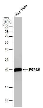Rat tissue extract (50 μg) was separated by 12% SDS-PAGE, and the membrane was blotted with PGP9.5 antibody (GTX109646) diluted at 1:10000.