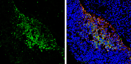 PGP9.5 antibody detects PGP9.5 protein expression by immunohistochemical analysis. Sample: Frozen sectioned E13.5 Rat brain. Green: PGP9.5 protein stained by PGP9.5 antibody (GTX109646) diluted at 1:250. Red: beta Tubulin 3/ TUJ1, a mature neuron marker, stained by beta Tubulin 3/ TUJ1 antibody [GT11710] (GTX631836) diluted at 1:500. Blue: Fluoroshield with DAPI (GTX30920).