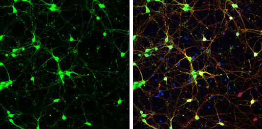 PGP9.5 antibody detects PGP9.5 protein at cytoplasm by immunofluorescent analysis. Sample: DIV9 rat E18 primary cortical neurons were fixed in 4% paraformaldehyde at RT for 15 min. Green: PGP9.5 protein stained by PGP9.5 antibody (GTX109646) diluted at 1:500. Red: beta Tubulin 3/ Tuj1, stained by beta Tubulin 3/ Tuj1 antibody [GT11710] (GTX631836) diluted at 1:500. Blue: Fluoroshield with DAPI (GTX30920).