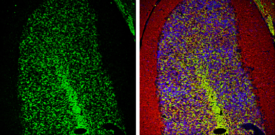 PGP9.5 antibody detects PGP9.5 protein expression by immunohistochemical analysis. Sample: Frozen-sectioned adult mouse cerebellum. Green: PGP9.5 protein stained by PGP9.5 antibody (GTX109646) diluted at 1:250. Red: beta Tubulin 3/ TUJ1, stained by beta Tubulin 3/ TUJ1 antibody [GT11710] (GTX631836) diluted at 1:500. Blue: Fluoroshield with DAPI (GTX30920).