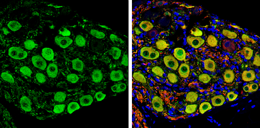 PGP9.5 antibody detects PGP9.5 protein by immunohistochemical analysis. Samples: Paraffin-embedded rat colon. Green: PGP9.5 protein stained by PGP9.5 antibody (GTX109646) diluted at 1:250. Red: beta Tubulin 3/ Tuj1, a marker, stained by beta Tubulin 3/ Tuj1 antibody [GT1338] (GTX631831) diluted at 1:500. Blue: Fluoroshield with DAPI (GTX30920). 
 Antigen Retrieval: Citrate buffer, pH 6.0, 15 min
