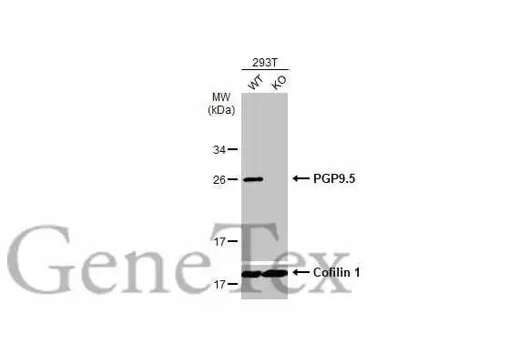 Wild-type (WT) and PGP9.5 knockout (KO) 293T cell extracts (30 μg) were separated by 12% SDS-PAGE, and the membrane was blotted with PGP9.5 antibody (GTX109646) diluted at 1:1000. The HRP-conjugated anti-rabbit IgG antibody (GTX213110-01) was used to detect the primary antibody.