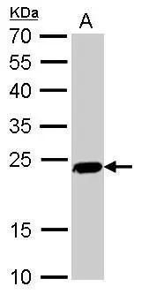 PGP9.5 antibody detects UCHL1 protein by Western blot analysis. A. 50 μg mouse brain lysate/extract 12 % SDS-PAGE PGP9.5 antibody (GTX109646) dilution: 1:5000