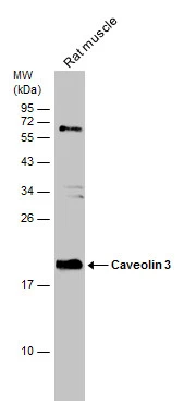 Rat tissue extract (50 μg) was separated by 12% SDS-PAGE, and the membrane was blotted with Caveolin 3 antibody [N1N2], N-term (GTX109650) diluted at 1:1000.