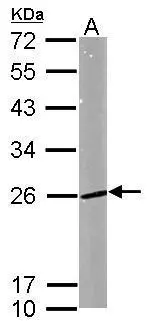 Sample (50 μg of whole cell lysate) A: mouse brain 12% SDS PAGE GTX109665 diluted at 1:1000 The HRP-conjugated anti-rabbit IgG antibody (GTX213110-01) was used to detect the primary antibody.
