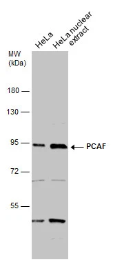 HeLa whole cell and nuclear extracts (30 μg) were separated by 7.5% SDS-PAGE, and the membrane was blotted with PCAF antibody [C3], C-term (GTX109666) diluted at 1:1000.