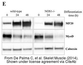 Various whole cell extracts (30 ug) were separated by 7.5% SDS-PAGE,and the membrane was blotted with Calnexin antibody [C3],C-term (GTX109669) diluted at 1:10000.