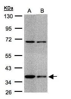 Immunohistochemical analysis of paraffin-embedded ES2 xenograft,using STUB1(GTX109676) antibody at 1:500 dilution. Antigen Retrieval: Trilogy? (EDTA based,pH 8.0) buffer,15min