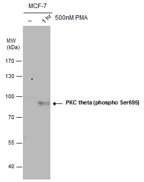 PKC theta (phospho Ser695) antibody detects PKC theta (phospho Ser695) protein by western blot analysis. Un-treated (-) and treated (+, 500nM PMA treatment for 1 hr) MCF-7 whole cell extracts (30 μg) were separated by 7.5% SDS-PAGE, and the membrane was blotted with PKC theta (phospho Ser695) antibody (GTX109689) at a dilution of 1:500.