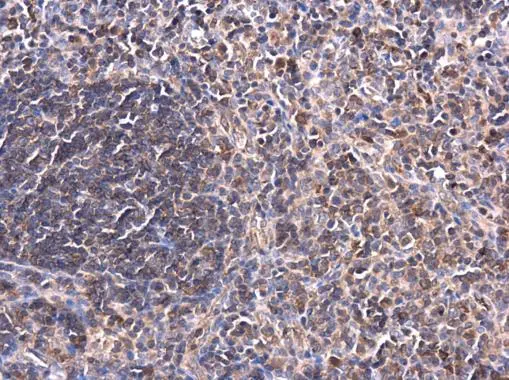 PKC theta antibody