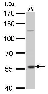 RAG2 antibody detects RAG2 protein by Western blot analysis. A. 50 μg Rat thymus lysate/extract 7.5 % SDS-PAGE RAG2 antibody (GTX109710) dilution: 1:1000
