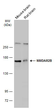 Various tissue extracts (50 μg) were separated by 5% SDS-PAGE, and the membrane was blotted with NMDAR2B antibody [C2C3], C-term (GTX109713) diluted at 1:3000. The HRP-conjugated anti-rabbit IgG antibody (GTX213110-01) was used to detect the primary antibody.