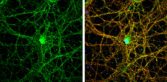 NMDAR2B antibody [C2C3], C-term detects NMDAR2B protein by immunofluorescent analysis. Sample: DIV14 rat E18 primary cortical neurons were fixed in 4% paraformaldehyde at RT for 15 min. Green: NMDAR2B protein stained by NMDAR2B antibody [C2C3], C-term (GTX109713) diluted at 1:500. Red: beta Tubulin 3/ Tuj1, stained by beta Tubulin 3/ Tuj1 antibody [GT1338] (GTX631831) diluted at 1:500. Blue: Fluoroshield with DAPI (GTX30920).