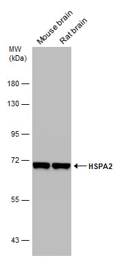 Various tissue extracts (50 μg) were separated by 7.5% SDS-PAGE, and the membrane was blotted with HSPA2 antibody [C1C3] (GTX109739) diluted at 1:1000.
