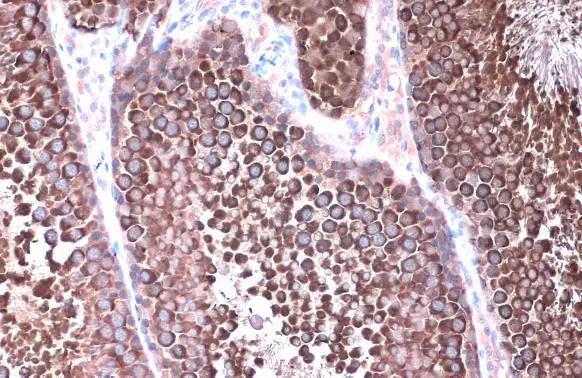 Anti-Hsp90 alpha antibody (GTX109753) | GeneTex