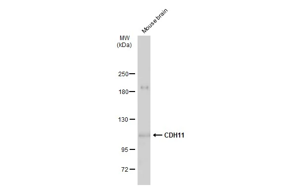 Mouse tissue extract (50 μg) was separated by 5% SDS-PAGE, and the membrane was blotted with CDH11 antibody (GTX109792) diluted at 1:1000. The HRP-conjugated anti-rabbit IgG antibody (GTX213110-01) was used to detect the primary antibody, and the signal was developed with Trident ECL plus-Enhanced.