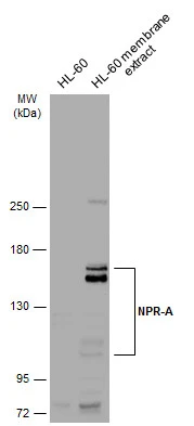 Immunofluorescence analysis of paraformaldehyde-fixed HeLa,using NPR-A (GTX109810) antibody at 1:200 dilution.