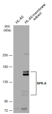 HL-60 whole cell and membrane extracts (30 μg) were separated by 5% SDS-PAGE, and the membrane was blotted with NPR-A antibody (GTX109810) diluted at 1:1000. The HRP-conjugated anti-rabbit IgG antibody (GTX213110-01) was used to detect the primary antibody.