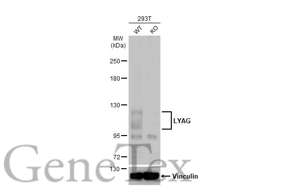 Wild-type (WT) and LYAG knockout (KO) 293T cell extracts (30 μg) were separated by 5% SDS-PAGE, and the membrane was blotted with LYAG antibody [C2C3], C-term (GTX109821) diluted at 1:200. The HRP-conjugated anti-rabbit IgG antibody (GTX213110-01) was used to detect the primary antibody.