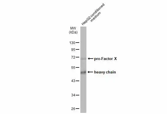 HepG2 conditioned medium (30 μg) was separated by 10% SDS-PAGE, and the membrane was blotted with Factor X antibody (GTX109830) diluted at 1:1000. The HRP-conjugated anti-rabbit IgG antibody (GTX213110-01) was used to detect the primary antibody.