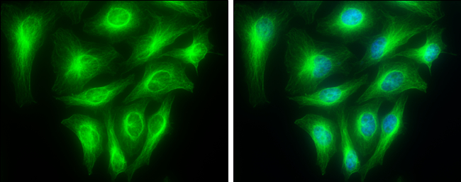 alpha Tubulin 1A antibody detects alpha Tubulin 1A protein at cytoskeleton by immunofluorescent analysis. Sample: HeLa cells were fixed in 4% paraformaldehyde at RT for 15 min. Green: alpha Tubulin 1A stained by alpha Tubulin 1A antibody (GTX109832) diluted at 1:500. Blue: Hoechst 33342 staining.