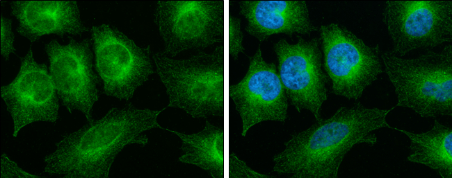 alpha Tubulin 1A antibody detects alpha Tubulin 1A protein at cytoskeleton by immunofluorescent analysis. Sample: HeLa cells were fixed in 4% paraformaldehyde at RT for 15 min. Green: alpha Tubulin 1A stained by alpha Tubulin 1A antibody (GTX109832) diluted at 1:500. Blue: Hoechst 33342 staining.