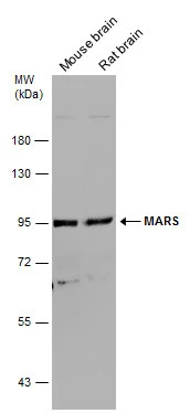 Various tissue extracts (50 μg) were separated by 7.5% SDS-PAGE, and the membrane was blotted with MARS antibody [N3C2], Internal (GTX109864) diluted at 1:1000.