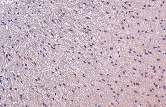 TCF3 / E2A antibody detects TCF3 protein at cytoplasm and nucleus by immunohistochemical analysis. Sample: Paraffin-embedded rat brain. TCF3 stained by TCF3 / E2A antibody (GTX109885) diluted at 1:500. Antigen Retrieval: Citrate buffer, pH 6.0, 15 min