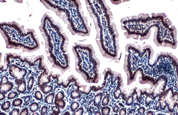 RBM15 antibody [N1N3] detects RBM15 protein at nucleus by immunohistochemical analysis. Sample: Paraffin-embedded mouse intestine. RBM15 stained by RBM15 antibody [N1N3] (GTX109899) diluted at 1:500. Antigen Retrieval: Citrate buffer, pH 6.0, 15 min